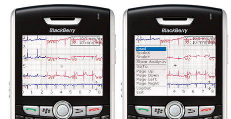 mVisum for BlackBerry EKG Screen Shots